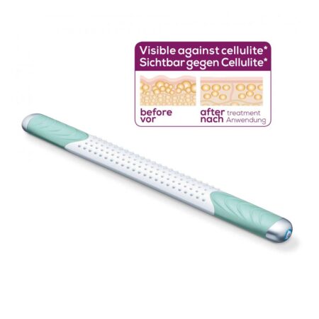 BEURER CM 100 ΣΥΣΚΕΥΗ ΜΑΣΑΖ ΓΙΑ ΤΑ ΠΟΔΙΑ & ΤΟ ΣΩΜΑ ΚΑΤΑ ΤΗΣ ΚΥΤΤΑΡΙΤΙΔΑΣ ΜΕ ΔΟΝΗΣΗBEU590031 Beurer - Image 1